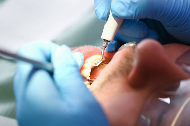 Best Emergency Dental Care for Trauma or Injury in Clanton, AL
