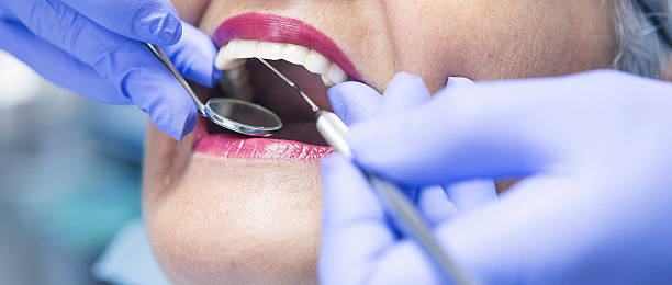 Best After-Hours Emergency Dentist in Clanton, AL